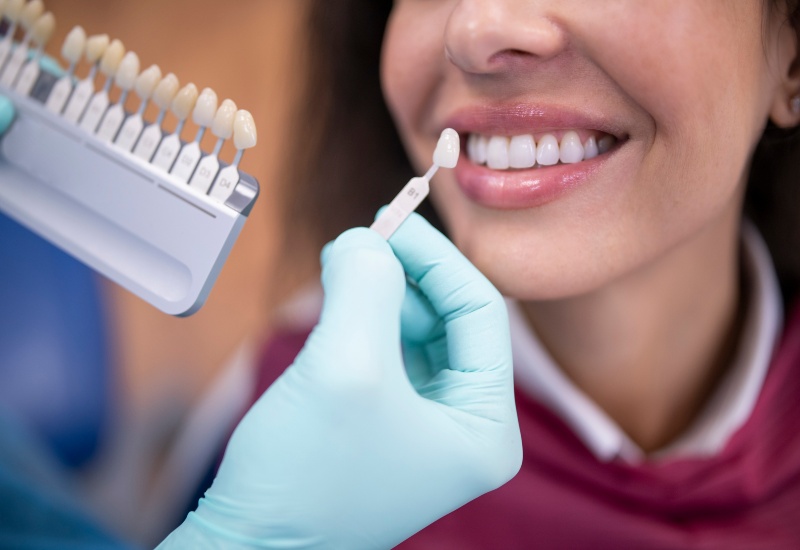 Tooth shade matching for teeth whitening at dental clinic in Plainfield, IN
